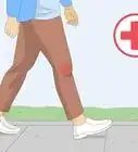 Heal a Meniscus Tear