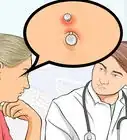Treat an Irritated Belly Button Piercing