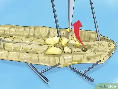 Image titled Dissect a Worm Step 9