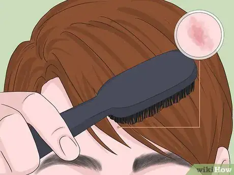 Image titled Cover a Bruise on Your Face Step 7