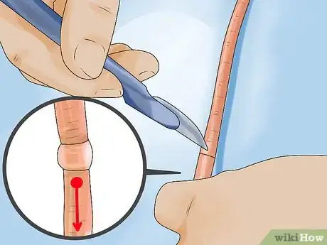 Image titled Dissect a Worm Step 4