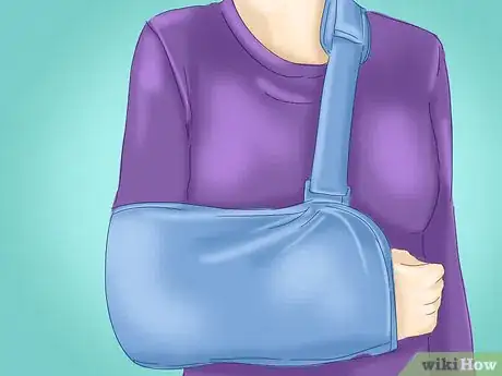 Image titled Treat a Clavicle Fracture Step 3