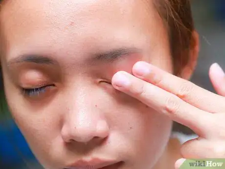Image titled Flip Eyelids Inside Out Step 16