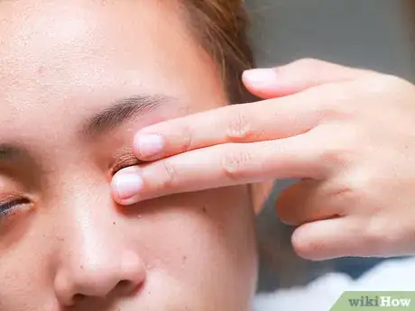 Image titled Flip Eyelids Inside Out Step 13