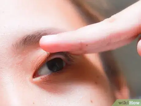 Image titled Flip Eyelids Inside Out Step 14