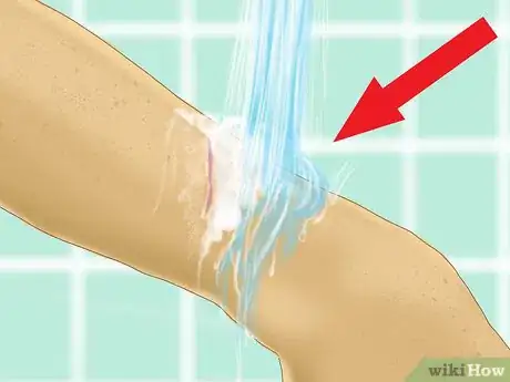 Image titled Heal a Cut Due to Dry Skin Step 6