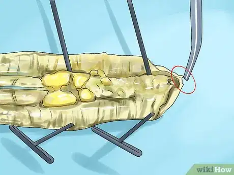 Image titled Dissect a Worm Step 11