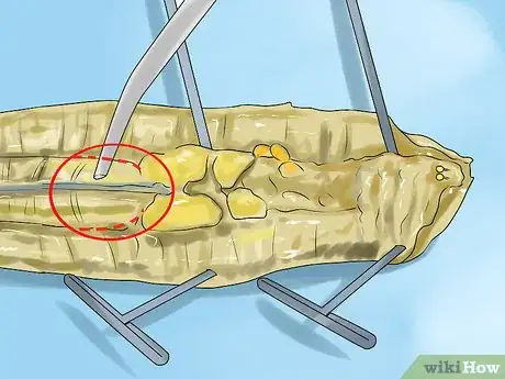 Image titled Dissect a Worm Step 15