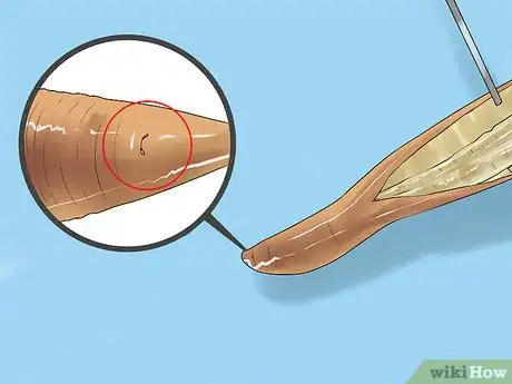 Image titled Dissect a Worm Step 17