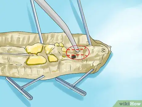 Image titled Dissect a Worm Step 13