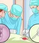 Get Rid of External Hemorrhoids Fast