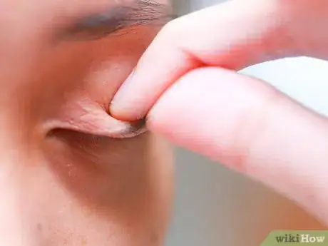 Image titled Flip Eyelids Inside Out Step 2