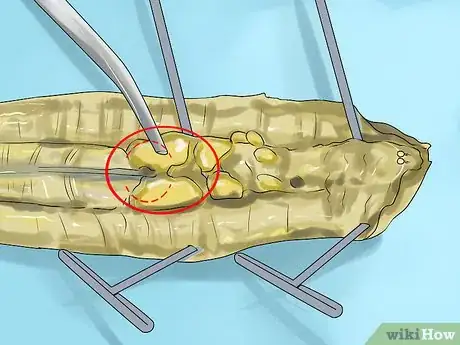 Image titled Dissect a Worm Step 14