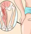 Know if You Have a Hernia