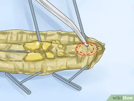 Image titled Dissect a Worm Step 12