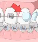 Heal a Cut in Your Mouth
