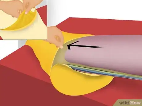 Image titled Make a Bolster Pillow Step 11
