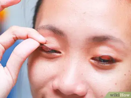 Image titled Flip Eyelids Inside Out Step 4