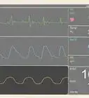 Read a Hospital Monitor
