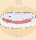 Make a Fake Retainer Out of Wax