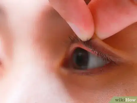 Image titled Flip Eyelids Inside Out Step 8