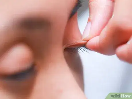 Image titled Flip Eyelids Inside Out Step 6