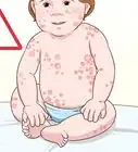 Switch Baby Formula