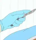Regrow Foreskin