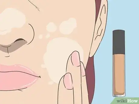Image titled Cover up Blackheads With Makeup Step 2