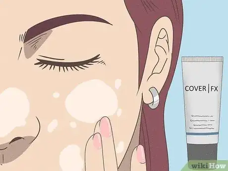 Image titled Cover up Blackheads With Makeup Step 1
