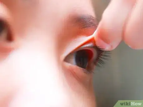 Image titled Flip Eyelids Inside Out Step 7