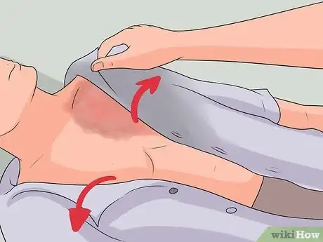 Image titled Treat a Hot Water Spill on Your Skin Step 13