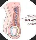 Treat Pain and Swelling in the Testicles