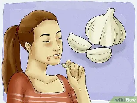 Imagen titulada Get Rid of a Cold Sore with Home Remedies Step 15