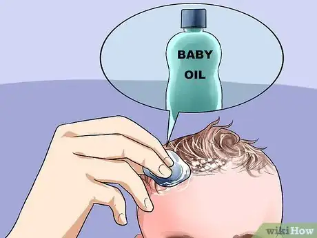 Imagen titulada Easily Clean Baby's Cradle Cap Dandruff Without Hurting the Baby Step 1