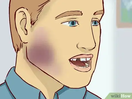 Imagen titulada Treat a Cut Lip Step 4