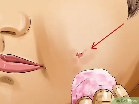 Imagen titulada Apply Witch Hazel to Your Face Step 5