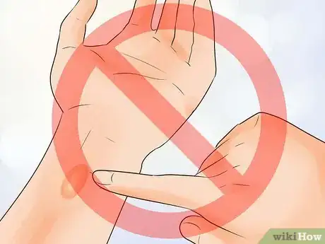 Imagen titulada Treat a Small Burn Step 10