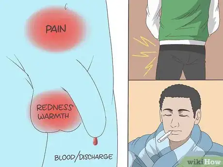 Imagen titulada Treat Epididymitis Step 1