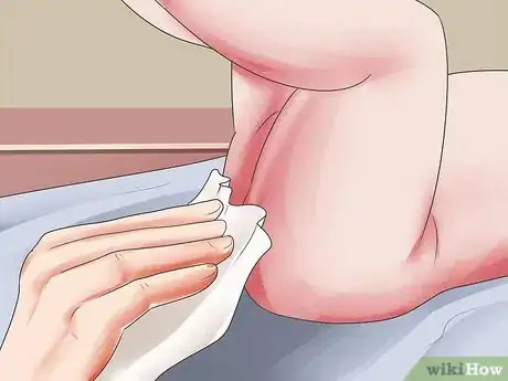 Imagen titulada Identify and Change a Soiled Diaper Step 4