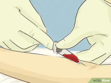 Imagen titulada Take Care of Dengue Patients Step 7