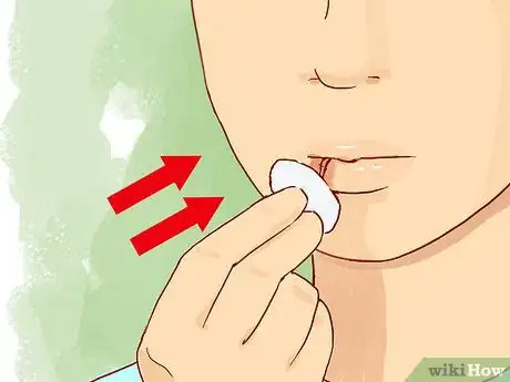 Imagen titulada Treat a Cut Lip Step 8