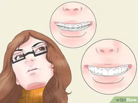 Imagen titulada Rock Both Braces and Glasses Step 5