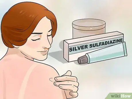 Imagen titulada Get Rid of a Sunburn Step 10