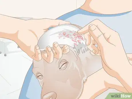 Imagen titulada Get Rid of a Rash on a Dog Step 7