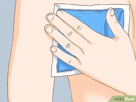 Imagen titulada Deal with Nipple Eczema Step 2