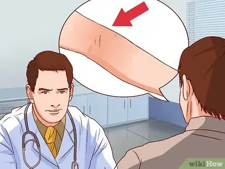 Imagen titulada Treat an Open Fracture During First Aid Step 11