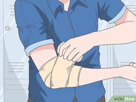 Imagen titulada Heal a Hyperextended Elbow Step 12