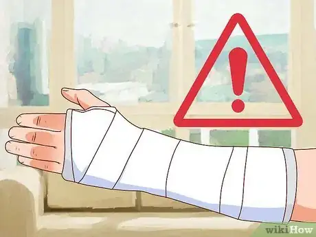 Imagen titulada Treat an Open Fracture During First Aid Step 14