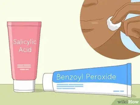 Imagen titulada Avoid Blind Pimples Step 2